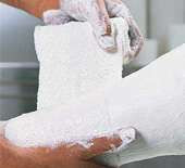 Gipszpólya P.O.P. 25414 15cm x 3m gyors kötésű (Lohman) 5db/csomag 