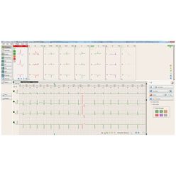 BTL CardioPoint Holter H100 szet