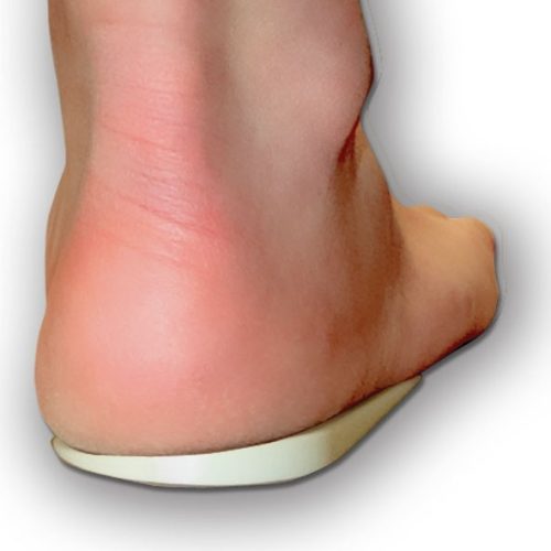 Valgus / pronációs korrekciós talpbetét 22-31