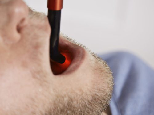 Energy-Laser L500 Pro