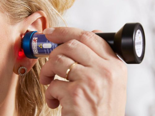 Personal Laser L400 lágylézer készülék